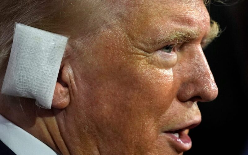 Trump is back out in the spotlight for the first time after his assassination attempt, and he's wearing a massive rectangular bandage over his ear