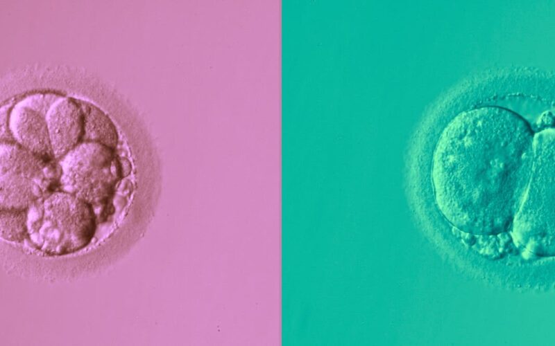 Can AI pick IVF embryos as well as a human? First randomised controlled trial shows promise