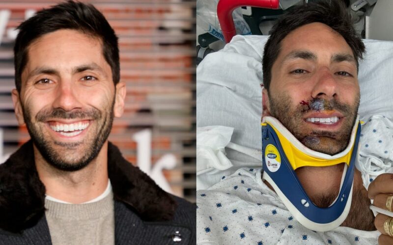 'Catfish' star Nev Schulman says he broke his neck in a collision with a truck: 'C5 and C6 to be exact'