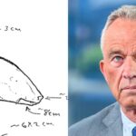 RFK Jr. stuck his hand in the Central Park bear's mouth. Necropsy shows he may have been knuckle-deep in her leaked brain.