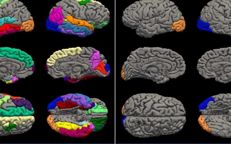 Brain scans show teen girls aged 4 years faster than boys during COVID lockdowns. We asked the researcher what that means long-term.