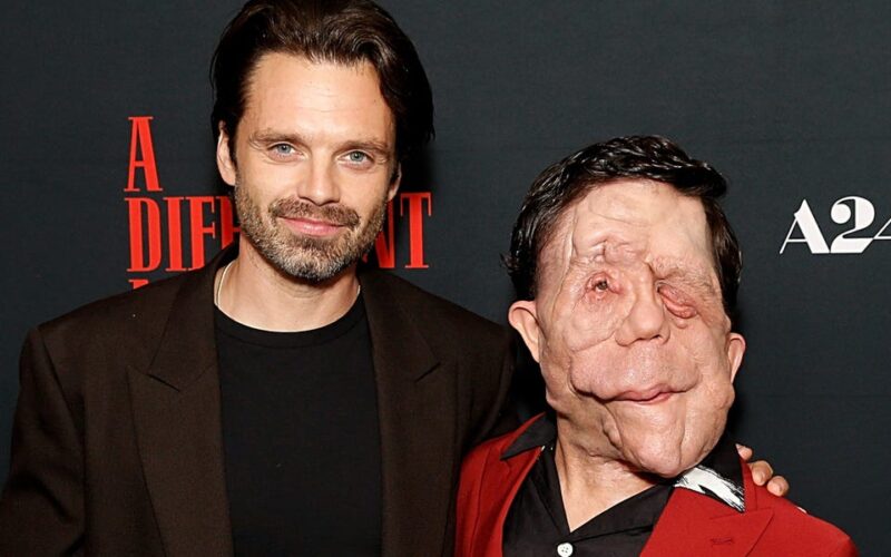 Everything to know about Adam Pearson, Sebastian Stan's scene-stealing costar in the A24 thriller 'A Different Man'