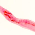 Tracking vampire worms with machine learning − using AI to diagnose schistosomiasis before the parasites causing it hatch in your blood