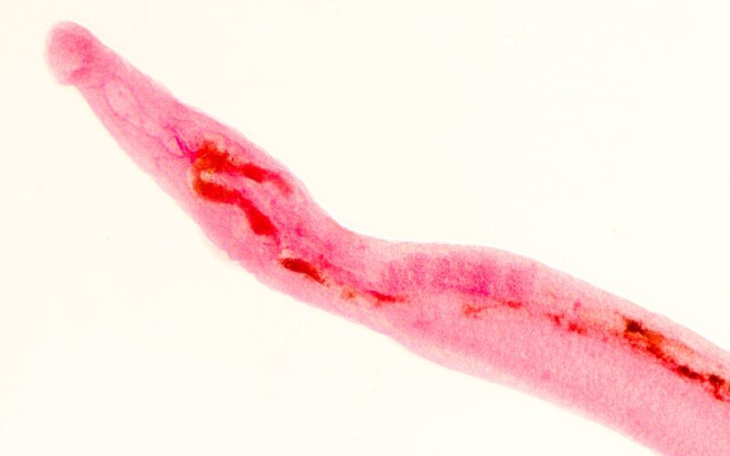 Tracking vampire worms with machine learning − using AI to diagnose schistosomiasis before the parasites causing it hatch in your blood