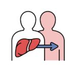 Does the UK’s liver transplant matching algorithm systematically exclude younger patients?